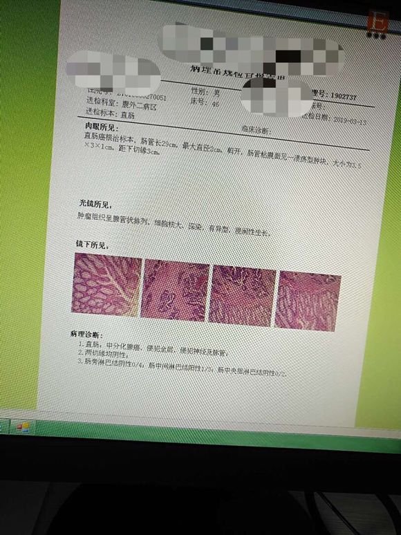 我父亲的病理结果，这个结果是什么情况？