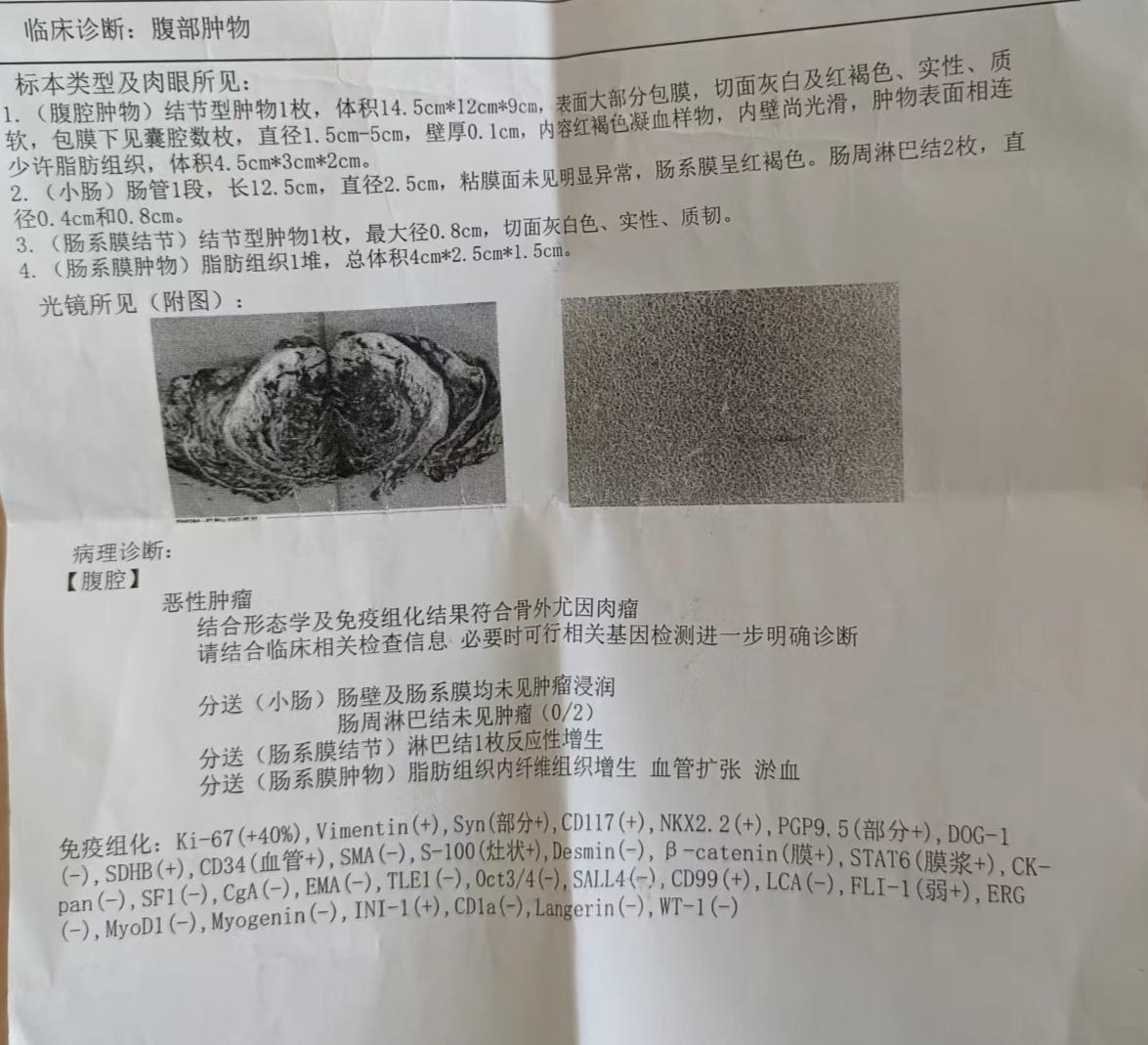 没想到如此罕见的病让我给摊上了