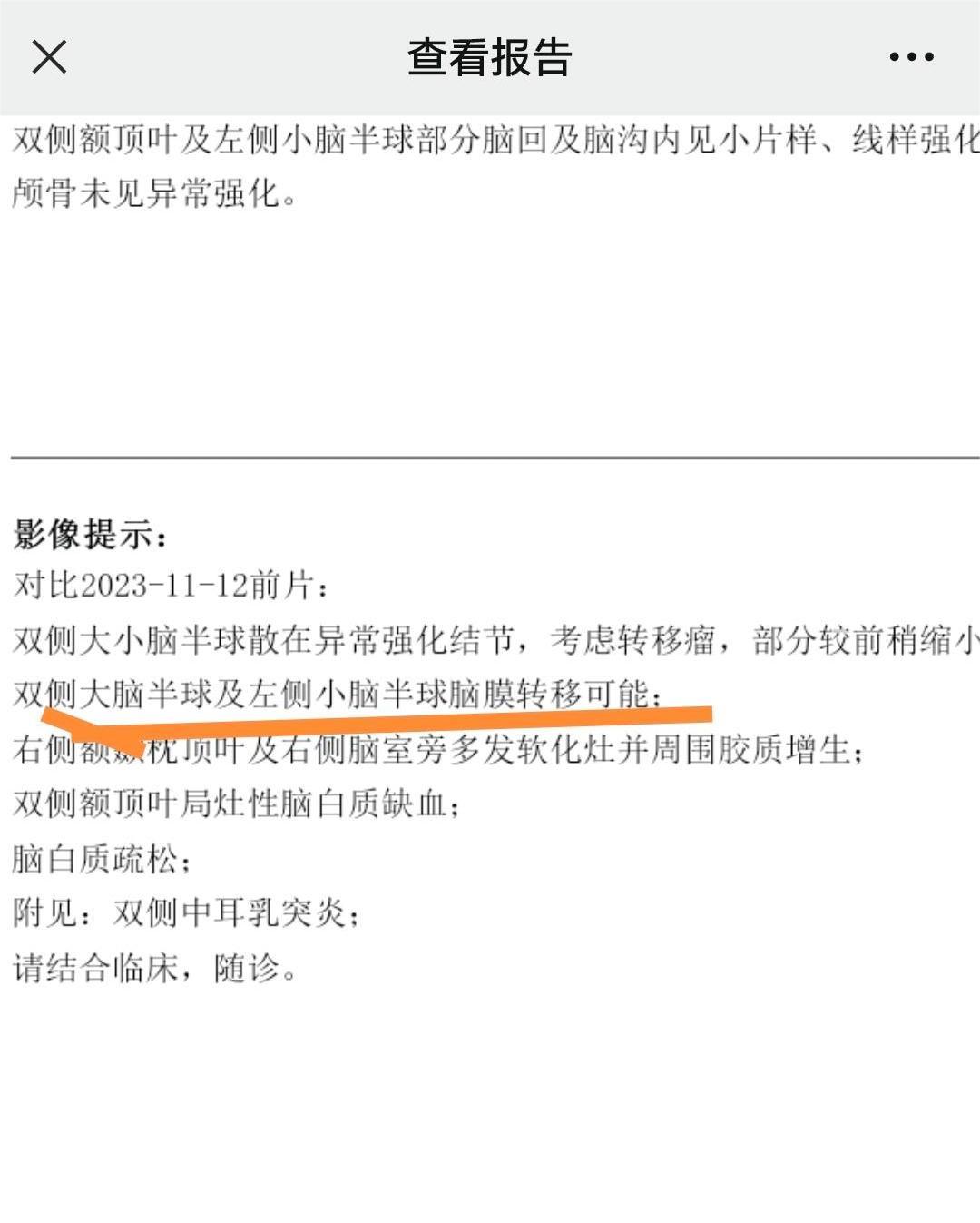 有做过鞘内注射的吗？风险大吗