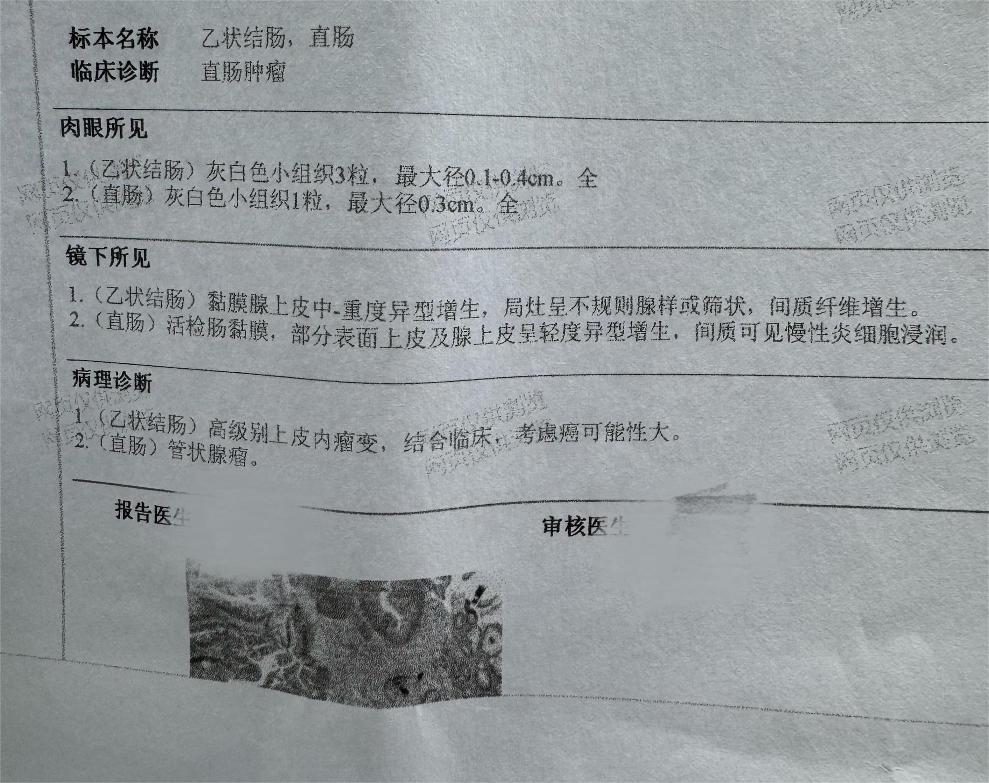 爸爸的病理出来了，有懂的吗，帮忙看看？